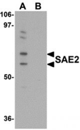 AP26207CP-N - SAE2 / UBA2