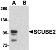 AP26234CP-N - SCUBE2