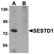 AP26250CP-N - SESTD1 / SOLO