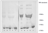 AM26061PU-N - C-reactive protein (CRP)
