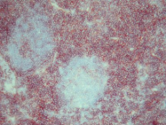 AM26052PU-N - CD3