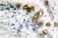 AP06106PU-N - ERCC1