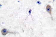 AP06278PU-N - PTCH1