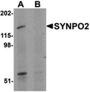 AP26296CP-N - SYNPO2