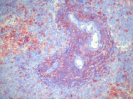AM26060BT-N - CD4