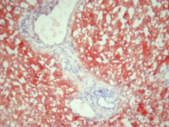 AM26062PU-N - Ferritin