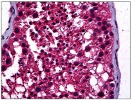 AM31022PU-N - STAT4