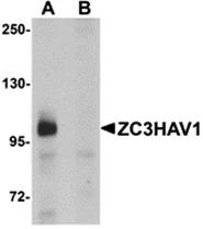 AP26229CP-N - ZC3HAV1