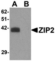 AP26307CP-N - Zinc transporter ZIP2 / SLC39A2