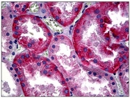 AM31043PU-N - CD147