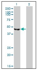 AM31050PU-N - Enolase beta