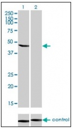 AM31050PU-N - Enolase beta