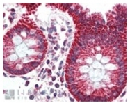 AP09637PU-N - TSPO / BZRP