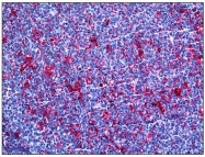 AM31077PU-N - Gelsolin