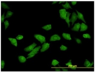 AM31093PU-N - Adapter protein CIKS