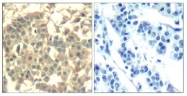 AP09516PU-N - HGF receptor