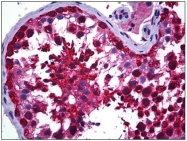 AM31096PU-N - CCT5 / TCP1 epsilon