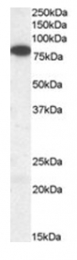 AP16208PU-N - VPS35 / MEM3