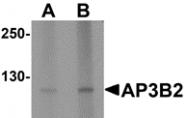 AP26159CP-N - AP3 complex subunit beta-2 / AP3B2