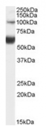 AP17055PU-N - HNF1 beta / TCF2