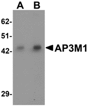 AP26158CP-N - AP3 complex subunit mu-1 / AP3M1