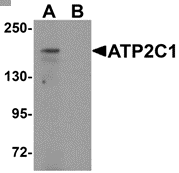 AP26124CP-N - ATP2C1