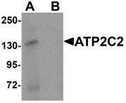 AP26125CP-N - ATP2C2