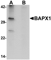 AP26106CP-N - BAPX1 / NKX3B
