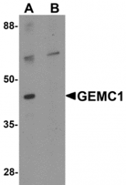 AP26154CP-N - GEMC1