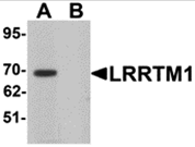AP26094CP-N - LRRTM1