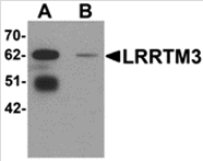 AP26096CP-N - LRRTM3