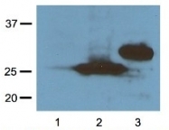 AM20837PU-N - RFP-Tag