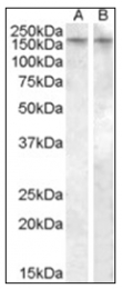 AP16979PU-N - Vasopressin V1b receptor (V1bR)