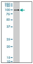 AM31124PU-N - DNA polymerase kappa