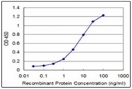 AM31131PU-N - NEK2