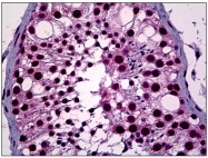 AM31132PU-N - NEUROD1