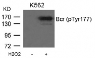 AP02468PU-S - BCR
