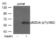AP02519PU-S - DOK1 / p62 dok