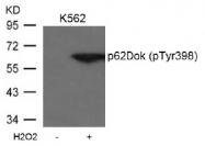AP02520PU-S - DOK1 / p62 dok