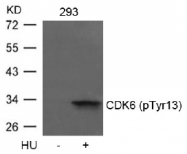 AP09488PU-N - CDK6