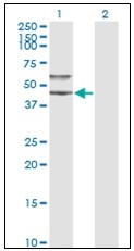 AM31140PU-N - Alpha-1-antichymotrypsin / ACT