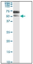 AM31140PU-N - Alpha-1-antichymotrypsin / ACT