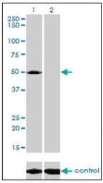 AM31142PU-N - ACP2 / LAP