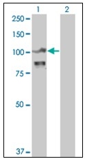 AM31143PU-N - Alpha-actinin-4 / ACTN4