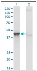 AM31144PU-N - Aminoacylase-1 / ACY1