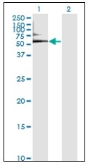 AM31145PU-N - Albumin