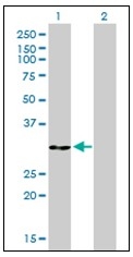 AM31146PU-N - Annexin A5 / ANXA5