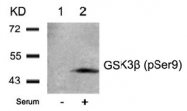AP02304PU-S - GSK3 beta