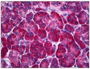 AM31148PU-N - Calreticulin