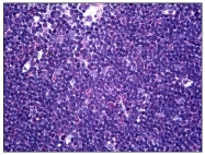 AM31149PU-N - CD58 / LFA3